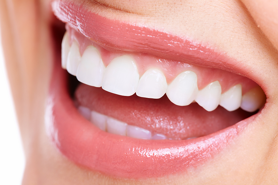 Can Adults Get Palatal Expanders? Exploring Expansion in Adulthood